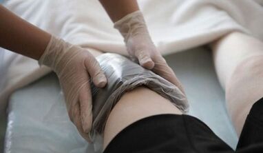 Métodos populares para tratar las venas varicosas en mujeres