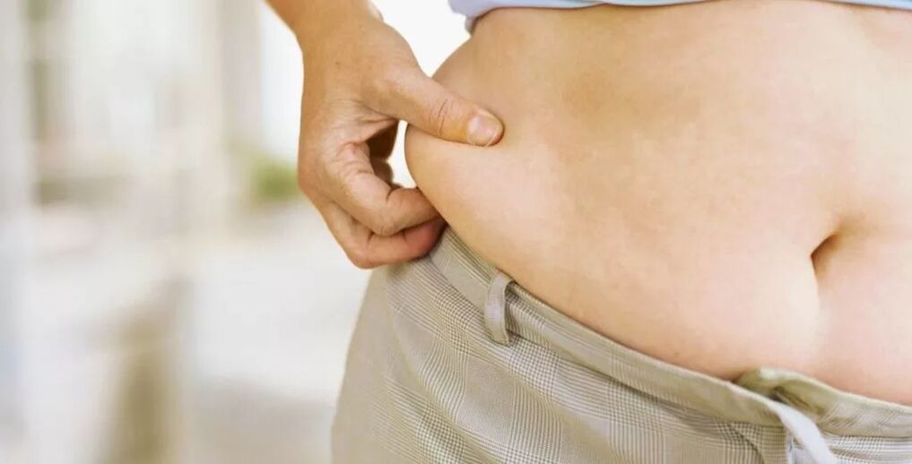 Exceso de peso y varices