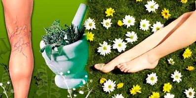 tratamiento de las venas varicosas con remedios caseros